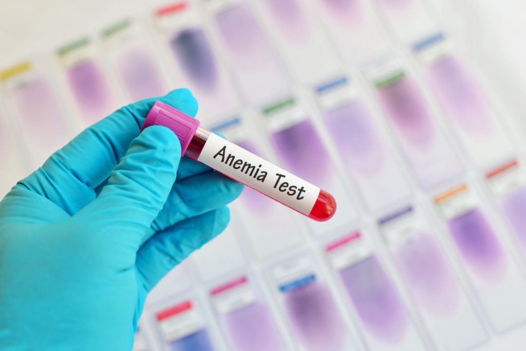 anemia ferropénica anemia ferropénica