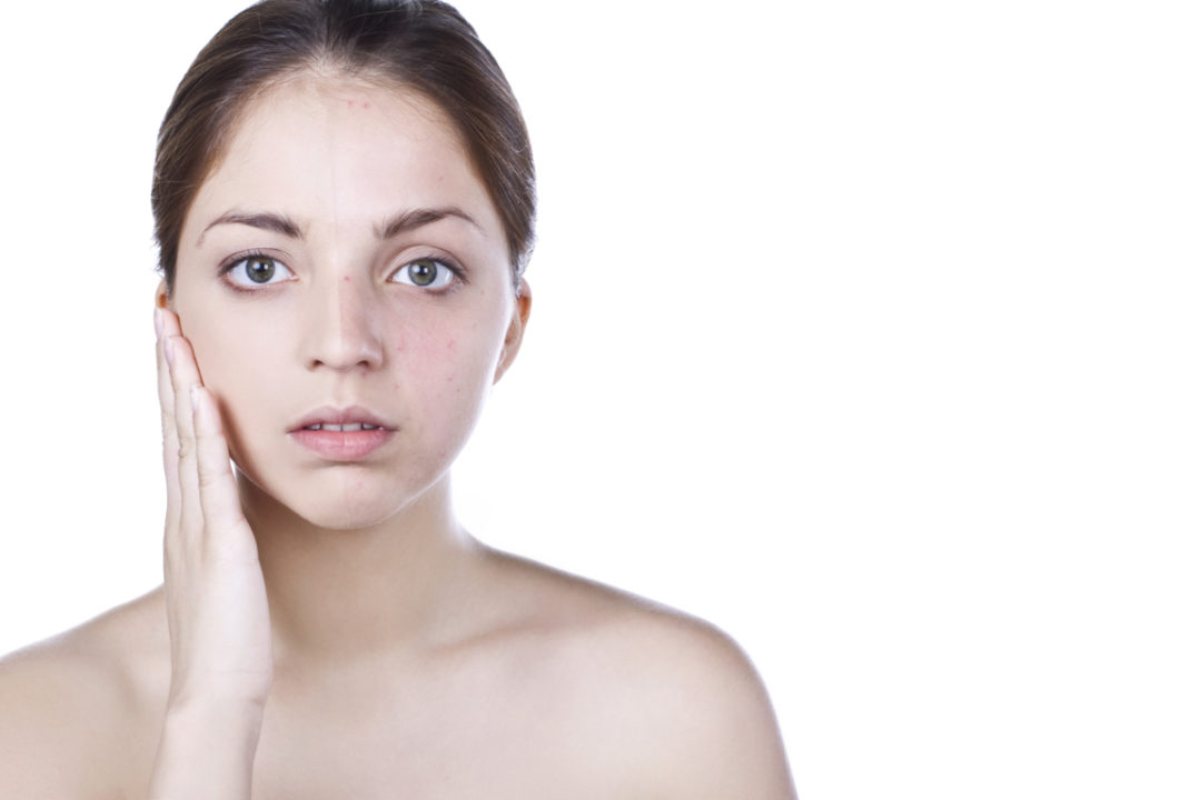 alergia al maquillaje