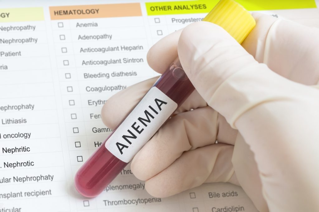 Cómo saber si tengo síntomas de anemia